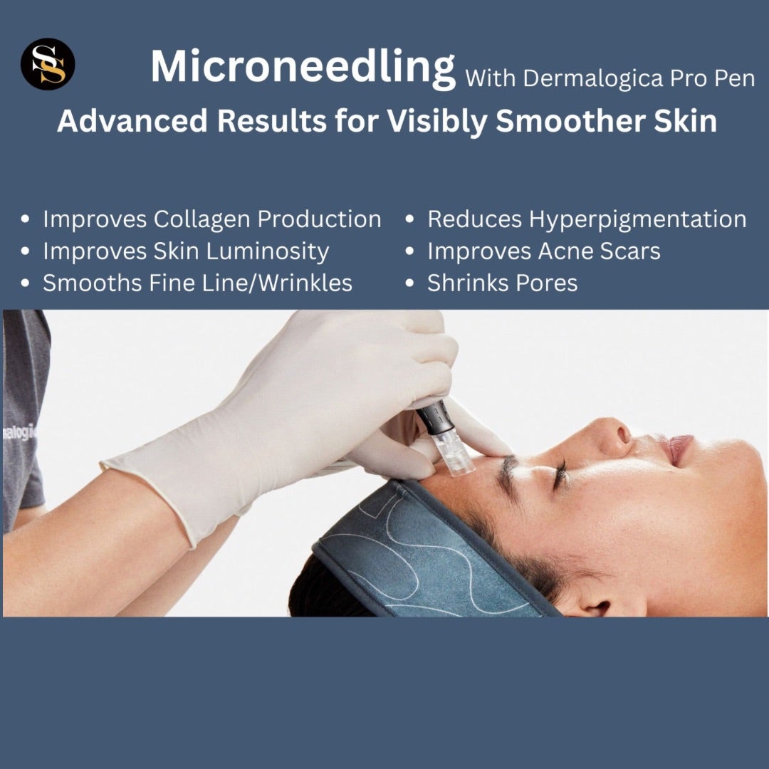 MicroNeedling | Smooth Solutions Laser Clinic, Ltd.